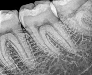 rayos x dental