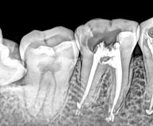 rayos x dental